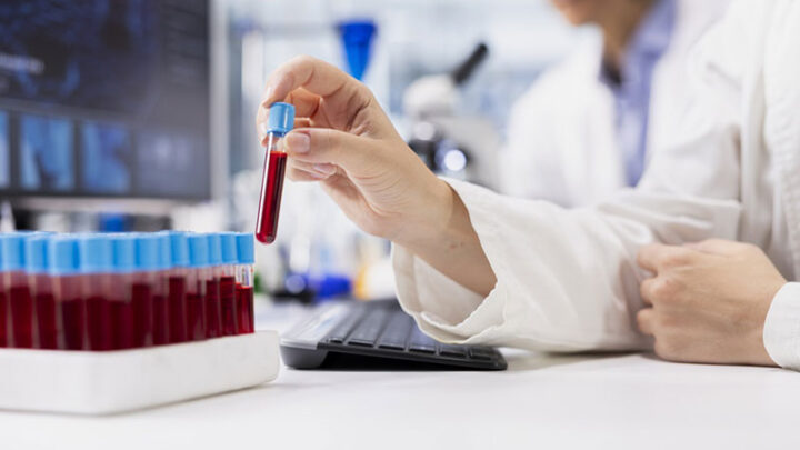 Epatite A: i consigli dei Servizi veterinari della ASL Lecce sul consumo di molluschi e altri cibi