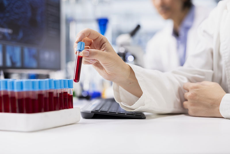 Epatite A: i consigli dei Servizi veterinari della ASL Lecce sul consumo di molluschi e altri cibi