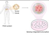 Ricerca UniSalento: tumore del pancreas, sensori “intelligenti” misurano la risposta alla chemioterapia